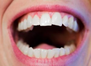 Teeth Mouth Hygiene Dental White Dentist